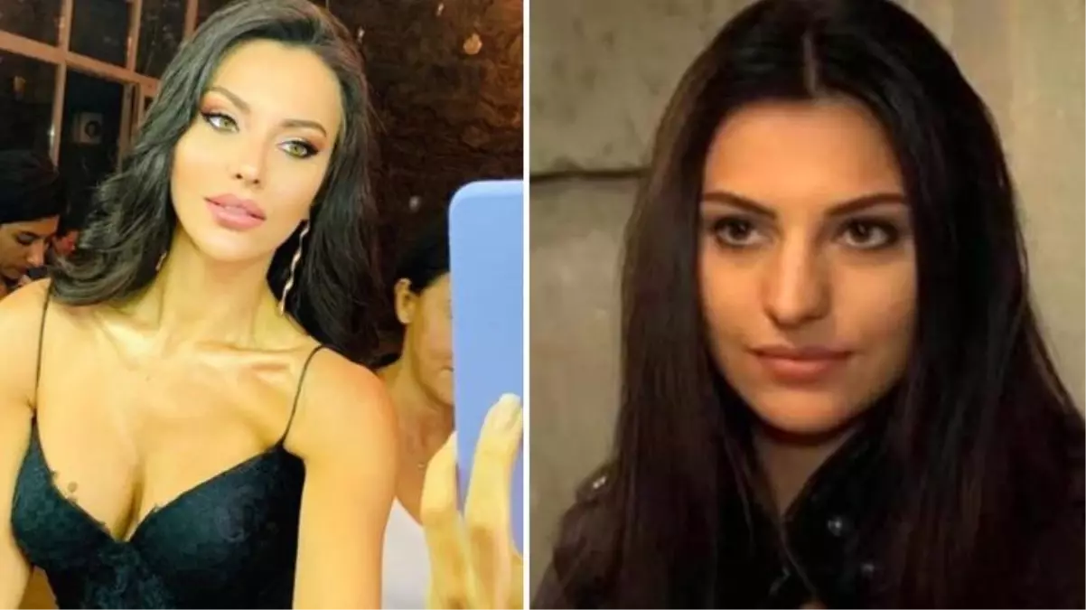 Estetiksiz fotoğrafını paylaştılar, Tuvana Türkay deliye döndü: Burnum dışında estetiğimi çıkarın ülkeyi terk ederim