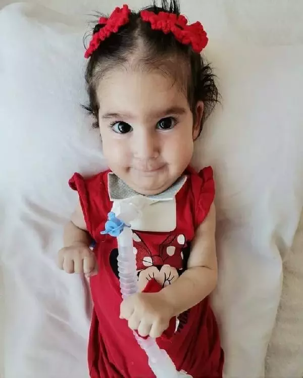 son dakika haberi sma li elif bebek hayatini kaybetti toplanan 2 4 milyon lira diger hastalara dagitilacak son dakika