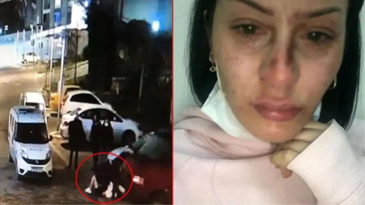 Polis tarafından dövülmesi nedeniyle şikayette bulunan kadından hayrete düşüren iddia: Doktor "Az bile benzetmişsiniz" dedi