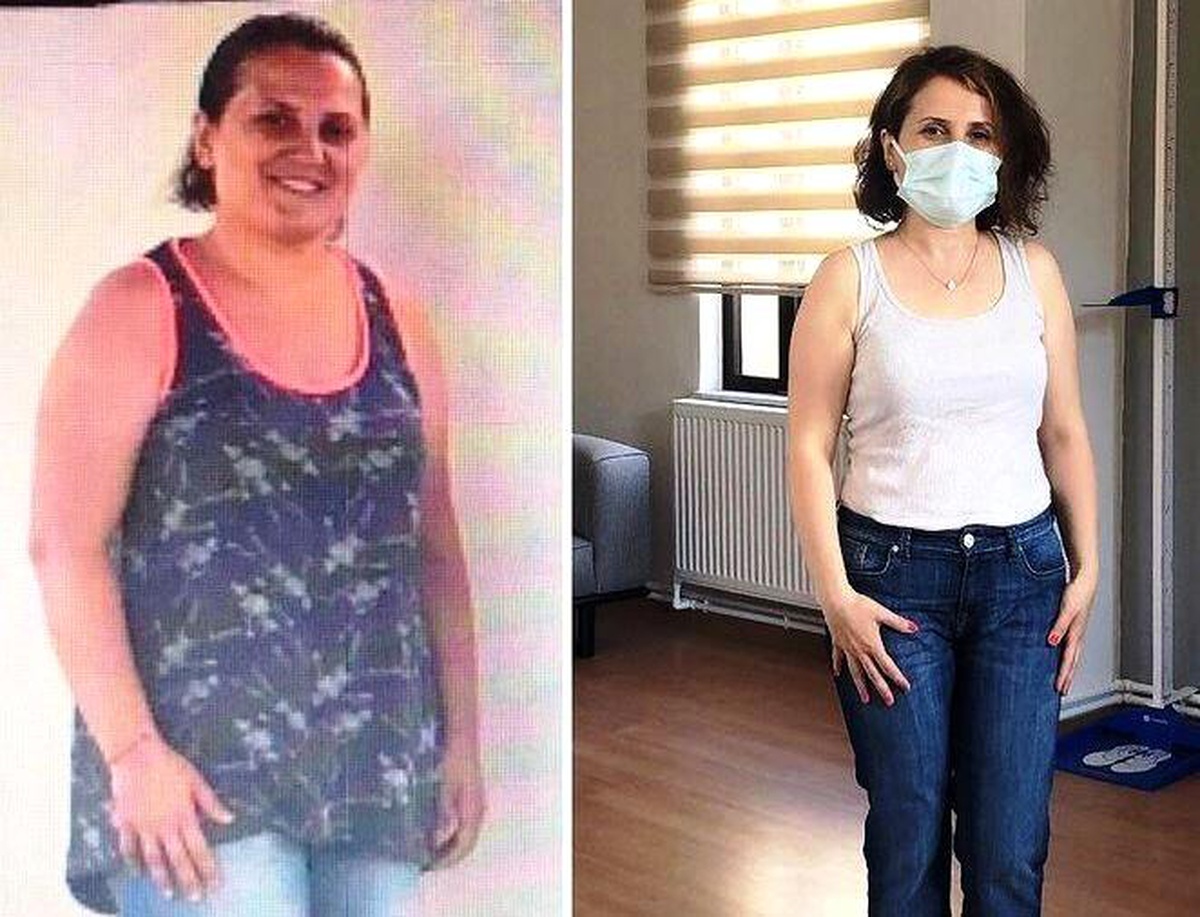 Yunusemre ile spor yaptı 6 ayda 10 kilo verdi