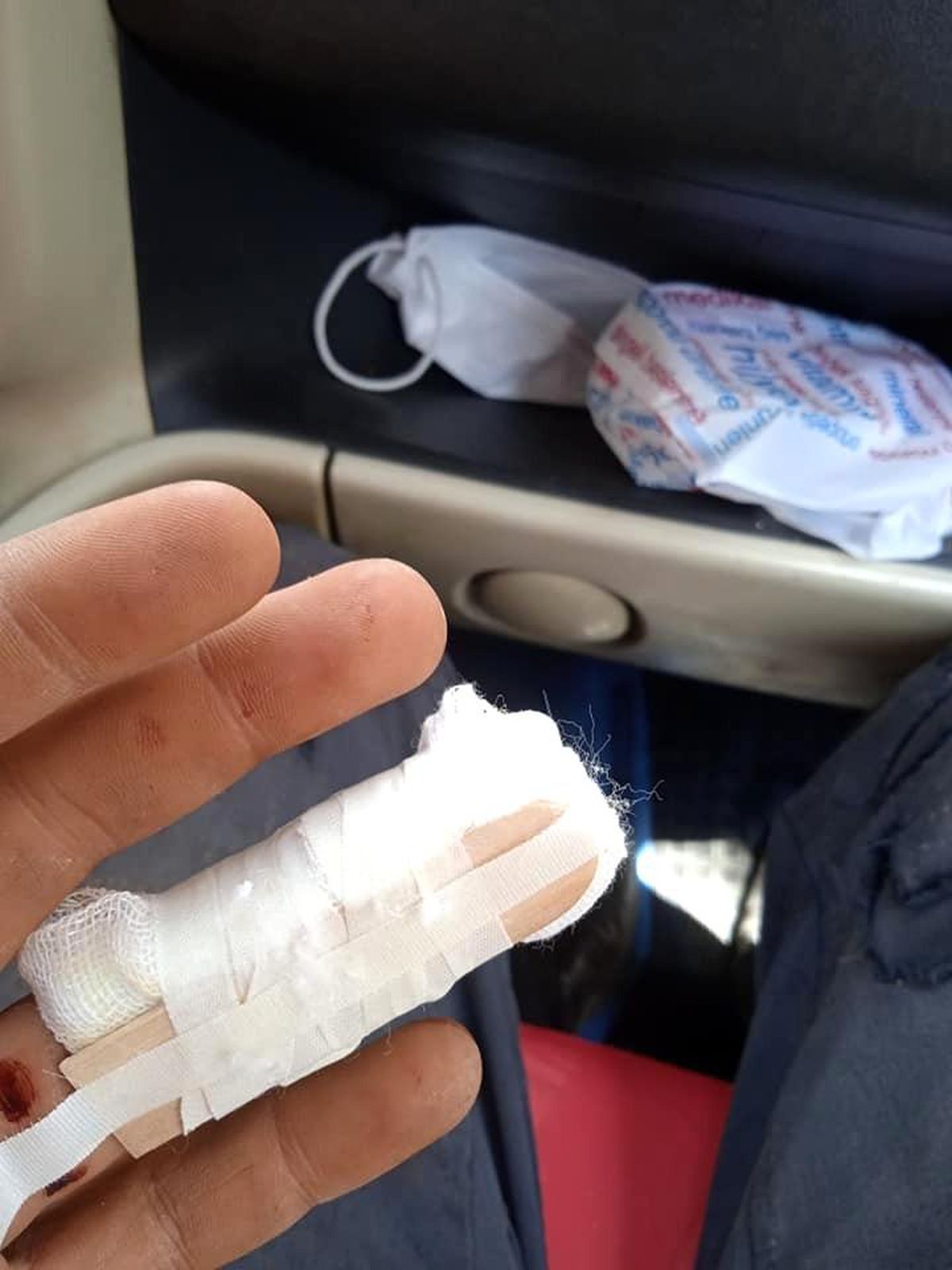 Parmağındaki 3 santimetrelik vidayla hastaneye koştu