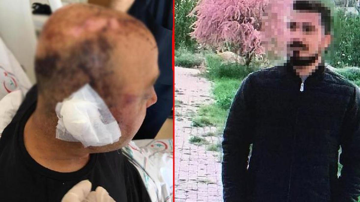 Telsizle polisi döven saldırganın savunması yok artık dedirtti: Olayları hatırlamıyorum