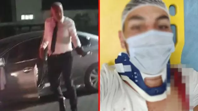 Bahşiş için düğün konvoyunun önünü kesen gençleri hastanelik ettiler Bahşiş için düğün konvoyunun önünü kesen gençleri hastanelik ettiler