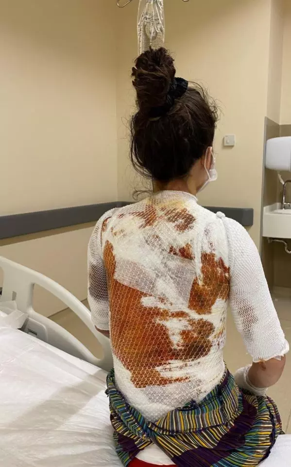 Eşi tarafından şiddet görüp, kaynar suyla yakılan kadın: Yarım kalan işini tamamlayacak Eşi tarafından şiddet görüp, kaynar suyla yakılan kadın: Yarım kalan işini tamamlayacak