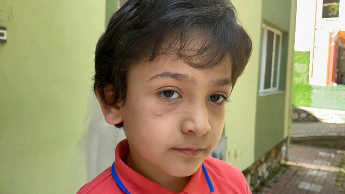 Sokak köpeği 8 yaşındaki Mehmet\'in yanağını koparıyordu