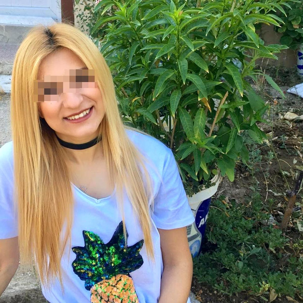 Son Dakika | Kazada kopan kol 7 saatlik operasyonun ardından yerine dikildi