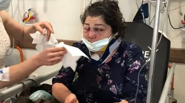 Belediye başkanının yanındakiler kadını darbetti, başkan kendini düşmüştür diye savundu Belediye başkanının yanındakiler kadını darbetti, başkan kendini düşmüştür diye savundu