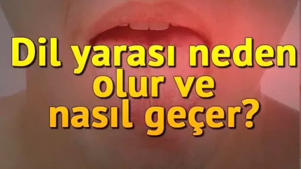 yatak yarasi neden olur