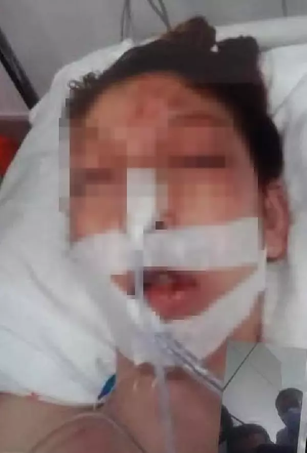 Cinsel istismara kalkışan sapığın ağır yaraladığı kızın babasından yürek yakan sözler Cinsel istismara kalkışan sapığın ağır yaraladığı kızın babasından yürek yakan sözler