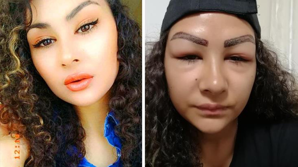 Reklam yüzü olma hayali yüzünden etti! Güzellik merkezi mağduru genç kız aynalara küstü