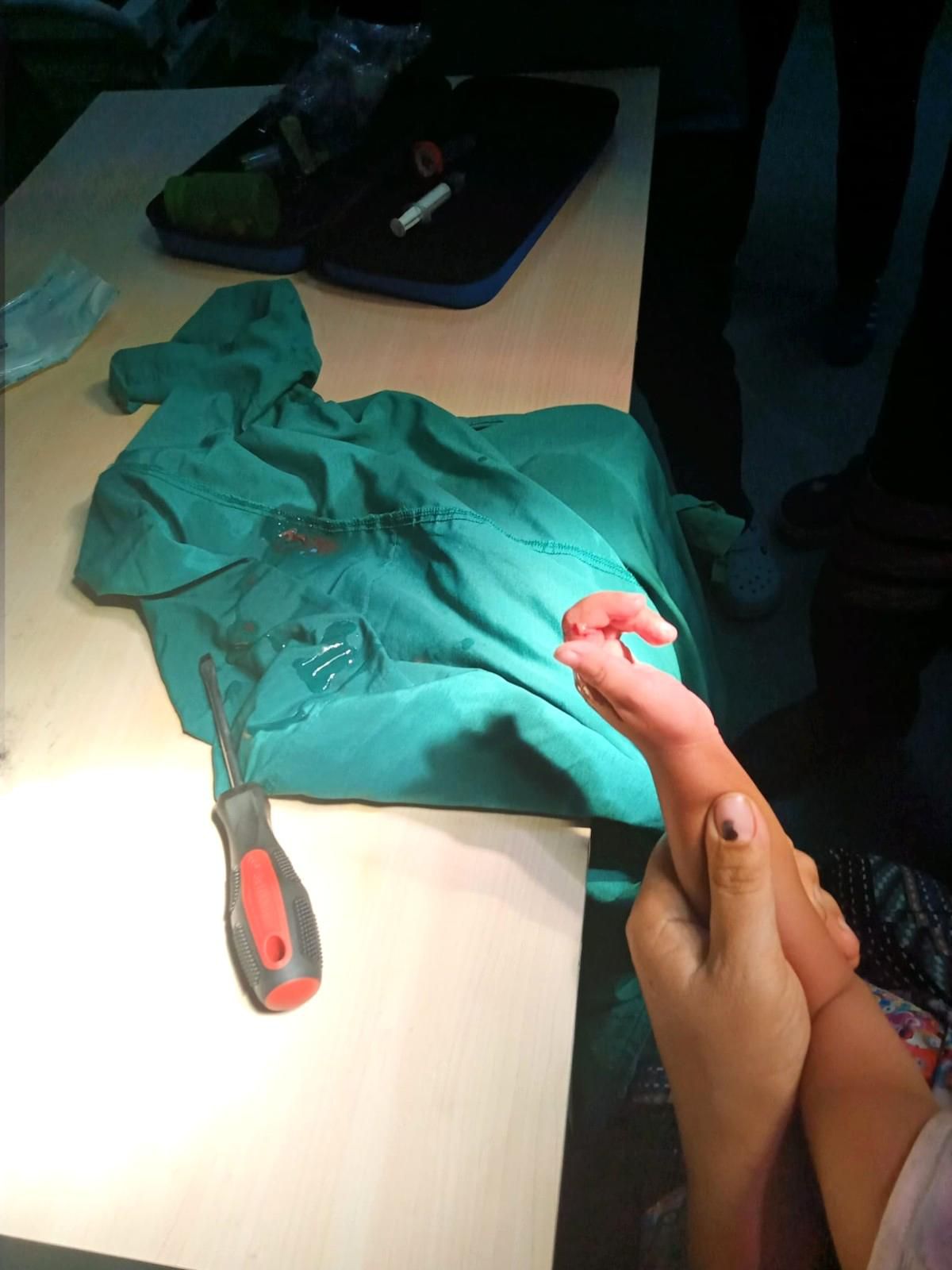 Parmağı korkuluğa sıkışan çocuğu AFAD ve itfaiye ekipleri kurtardı