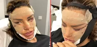 Katie Price estetiğe doyamıyor, eski kocası kızdı: Bari biraz çocuklarını düşün!