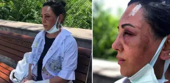 Spor eğitmeni kadın, eski sevgilisi tarafından 20 dakika boyunca takside darbedildi