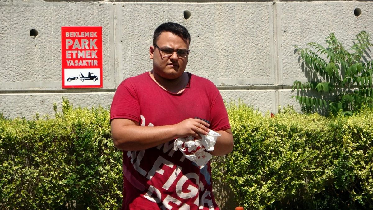 Kendini yaralayan acemi kasaplar, hastaneye akın etti