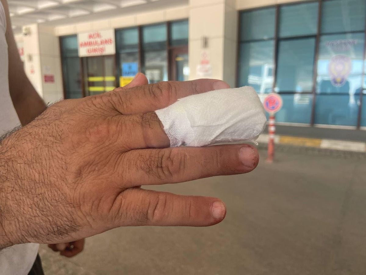 Trakya\'da acemi kasaplar hastanelik oldu