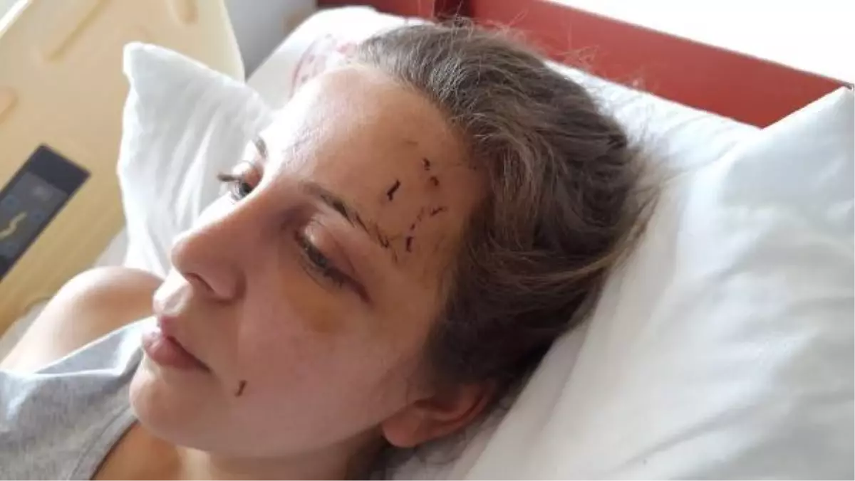 ESKİ EŞİNİN 5 SAAT ŞİDDET UYGULADIĞI KADIN: KIZIMI DA ALIP KAÇTI