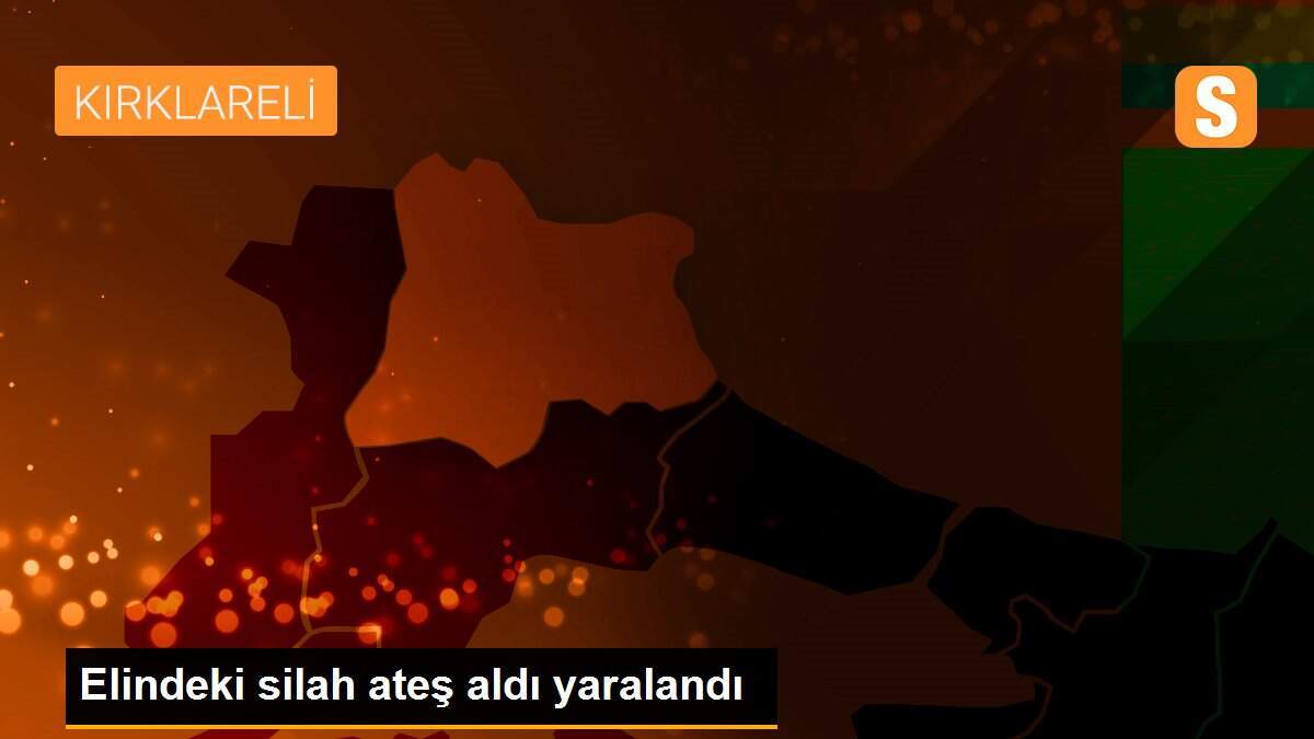 Elindeki silah ateş aldı yaralandı