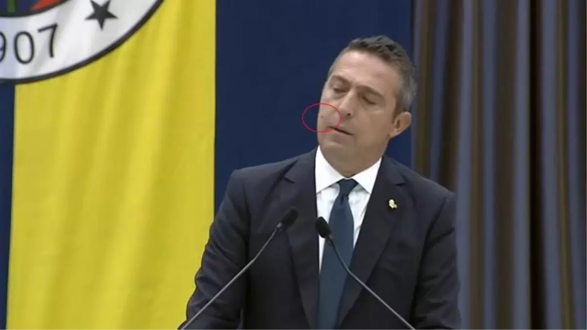 Sinek saldırısıyla mücadele eden Ali Koç\'un tepkileri gülmekten kırdı geçirdi