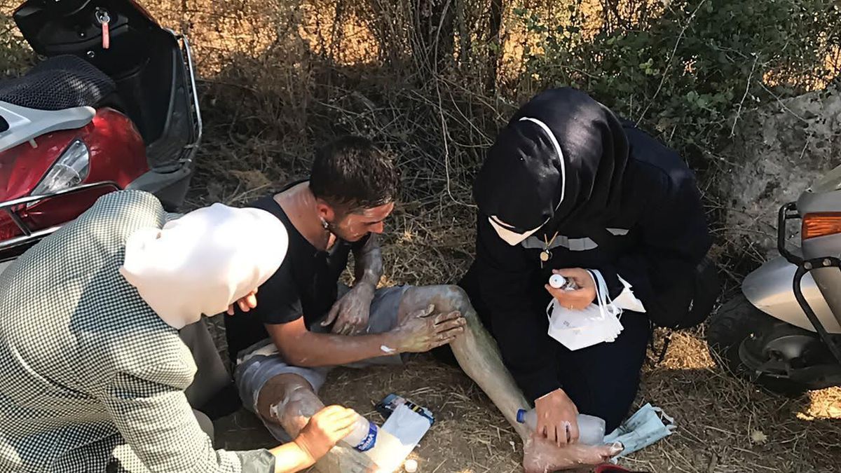 Muğla\'da yangından vücudu yanan gence ilk müdahaleyi Malatya Milletvekili Çalık yaptı