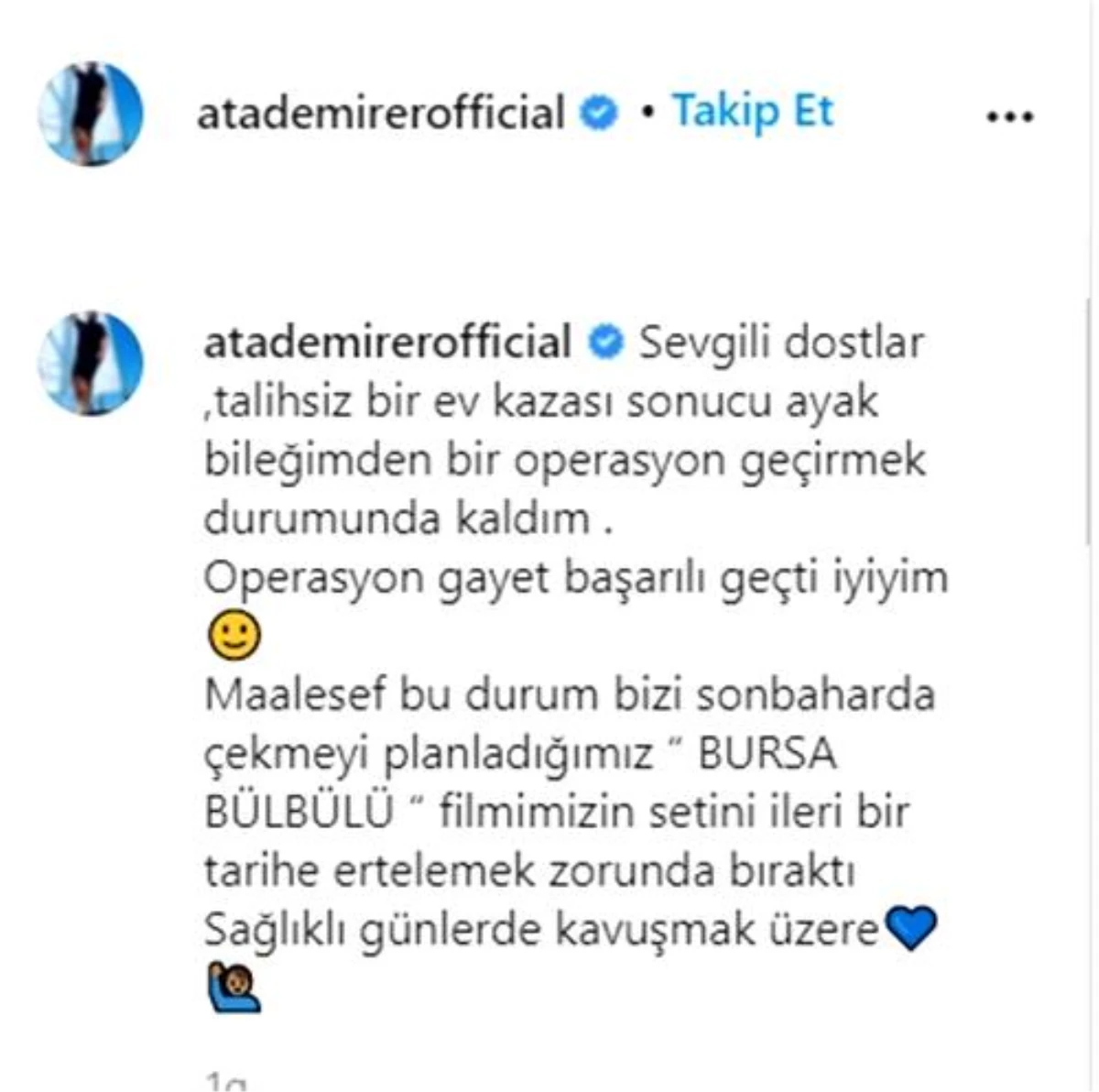 Ata Demirer, evde kaza geçirdi, ayak bileğinden ameliyat oldu