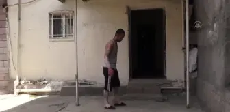 17 yıldır sedef hastalığıyla mücadele eden genç tedavi olmak istiyor