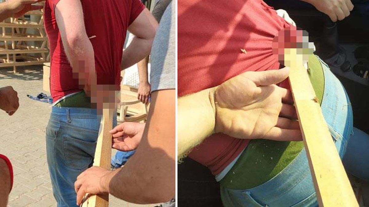 Son dakika! Fırlayan ağaç parçası atölyeyi kana buladı! Genç işçi, karnından girip sırtından çıkan parça yüzünden yaşam savaşı veriyor