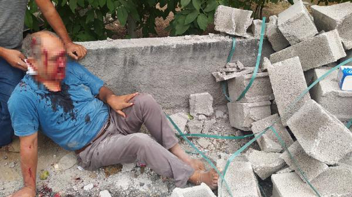 Yolda yürürken kamyondan düşen briketlerin altında kalıp, yaralandı