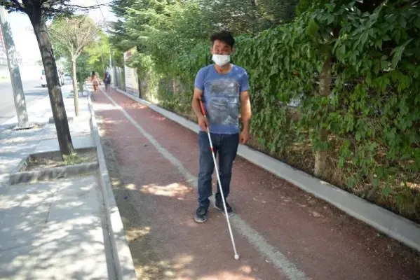 Yüzünün yarısını kaybeden Ahmet'in tek hayali normal insanlar gibi yaşamak