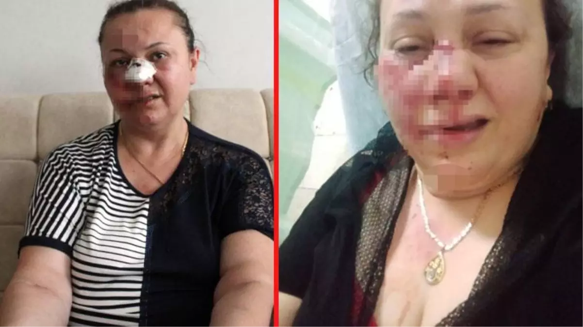 46 yaşındaki kadın, eski erkek arkadaşı darp edildikten sonra hastane önün atıldı