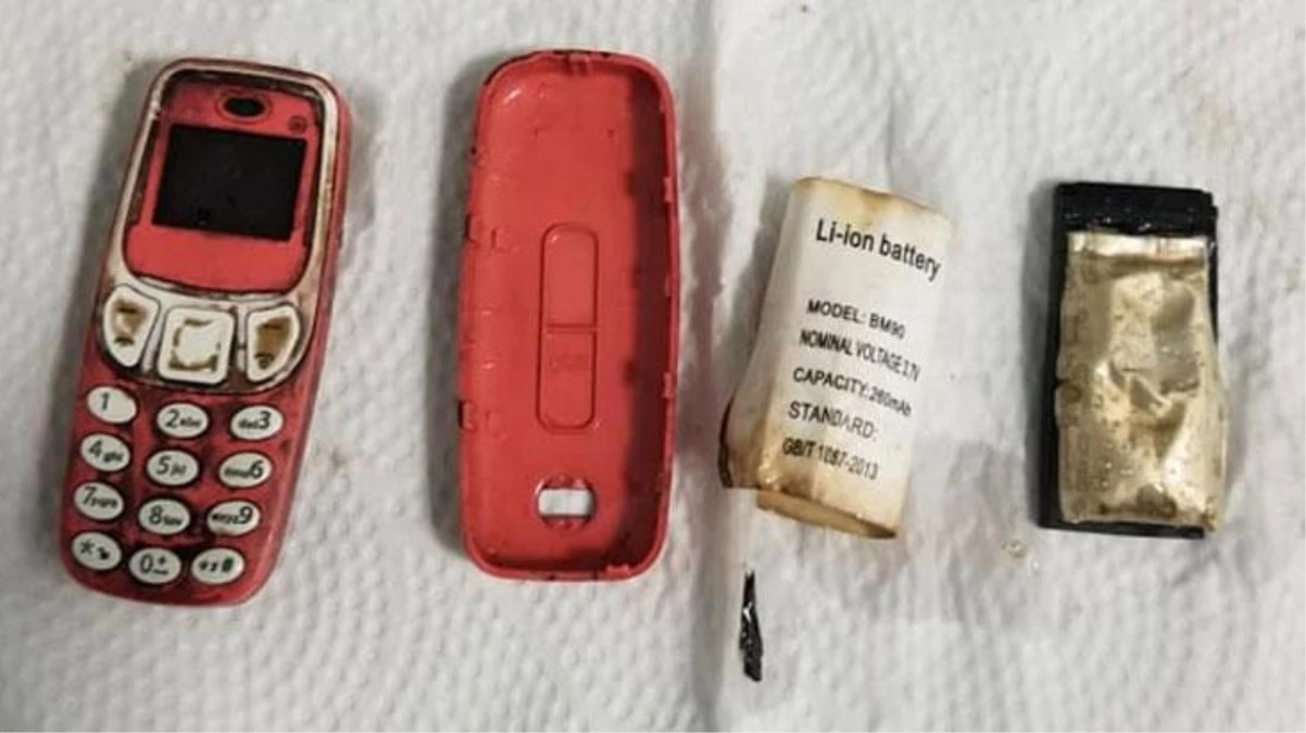 Kosova\'da akılalmaz olay! 33 yaşındaki bir hastanın midesinden Nokia 3310 çıktı