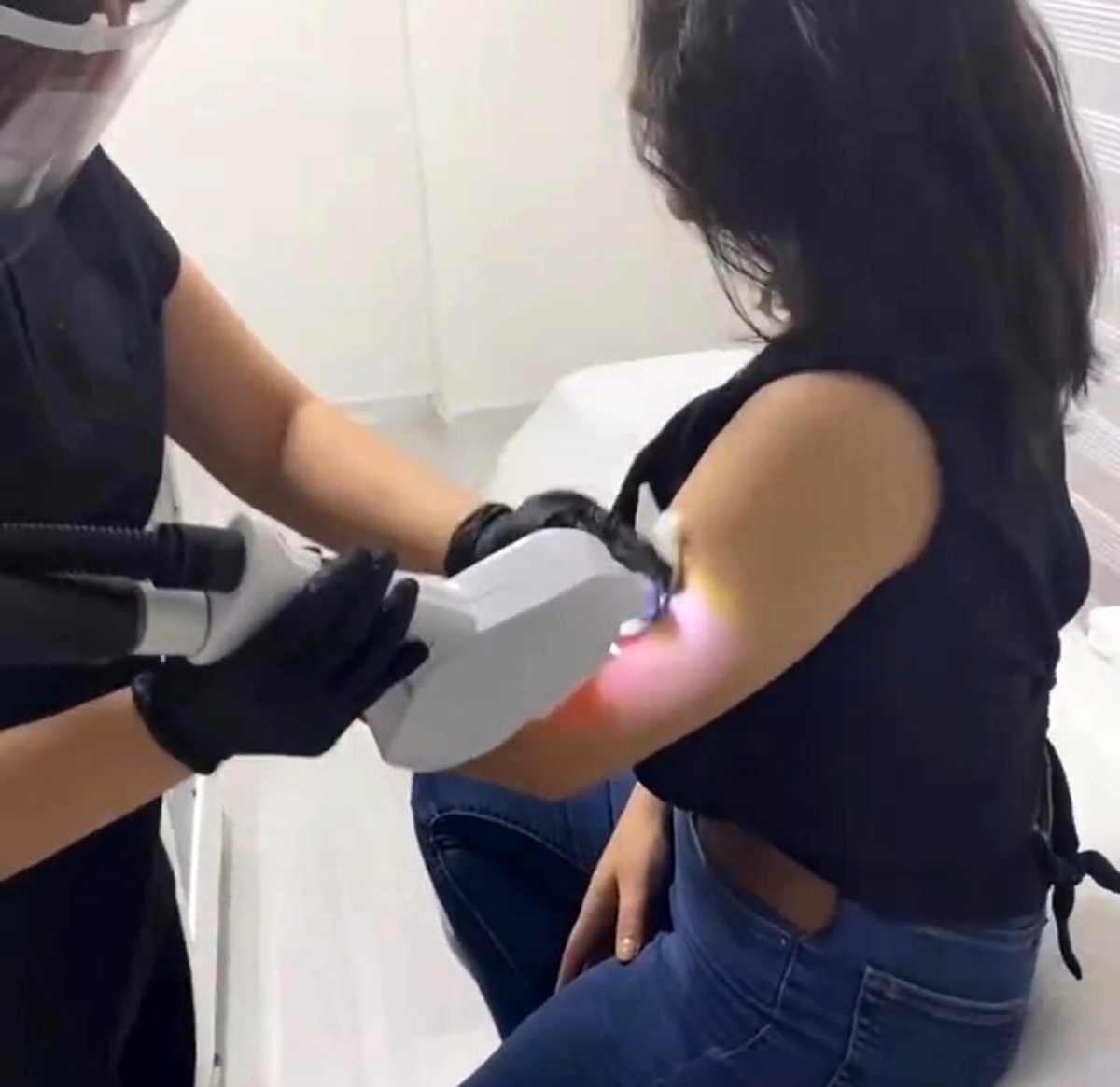 Lazer epilasyon ile istenmeyen tüylere kalıcı çözüm