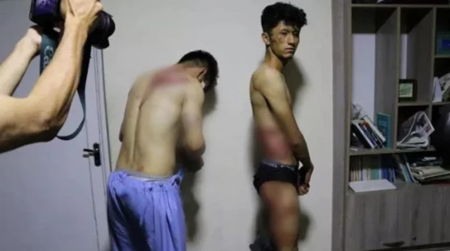 Taliban, Afgan gazetecilere 4 saat işkence etti! Vücutlarındaki morluklar, şiddetin boyutunu ortaya koydu