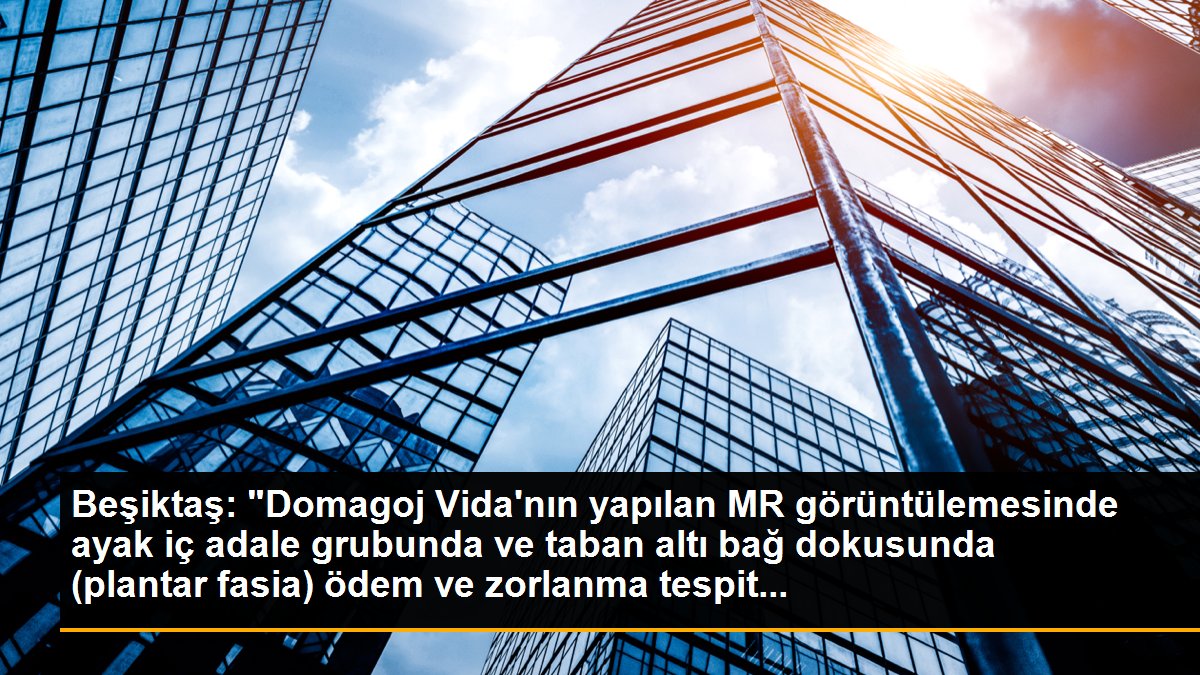 Beşiktaş: "Domagoj Vida\'nın yapılan MR görüntülemesinde ayak iç adale grubunda ve taban altı bağ dokusunda (plantar fasia) ödem ve zorlanma tespit...