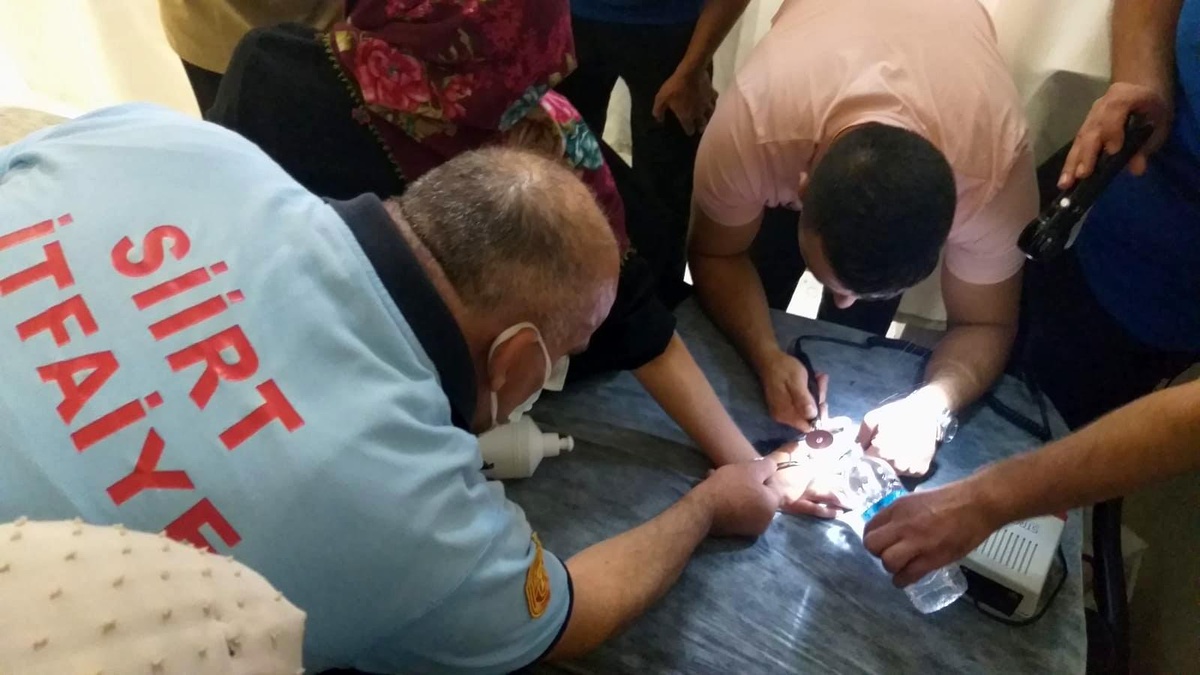 17 yaşındaki kızın parmağına sıkışan yüzük, itfaiye ekiplerinin çalışması ile çıkarıldı