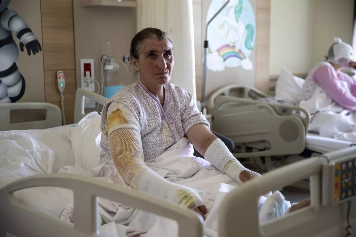 Tandıra düşen ve vücudunda yanıklar oluşan kadın tedavi altına alındı