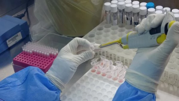 Prof. Dr. Aydın: Vaka sayılarını düşüremezsek kapanmak zorunda kalacağız Prof. Dr. Aydın: Vaka sayılarını düşüremezsek kapanmak zorunda kalacağız