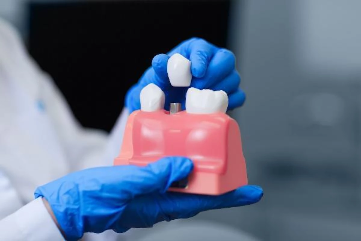 "Diş kaybı sorunlarında implant tedavisi en çok tercih edilen çözümler arasında"