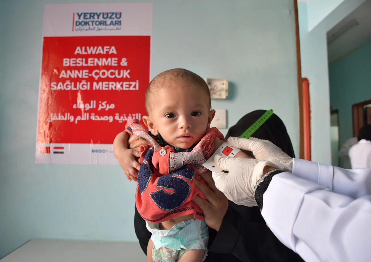 Yeryüzü Doktorları Yemen\'de açlık nedeniyle sağlıklarından olan çocuklara şifa dağıtmayı sürdürüyor