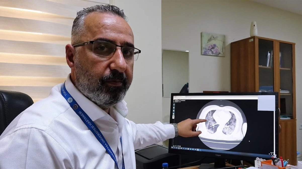 Aşısız hastaların akciğer tomografisini paylaşarak uyardı