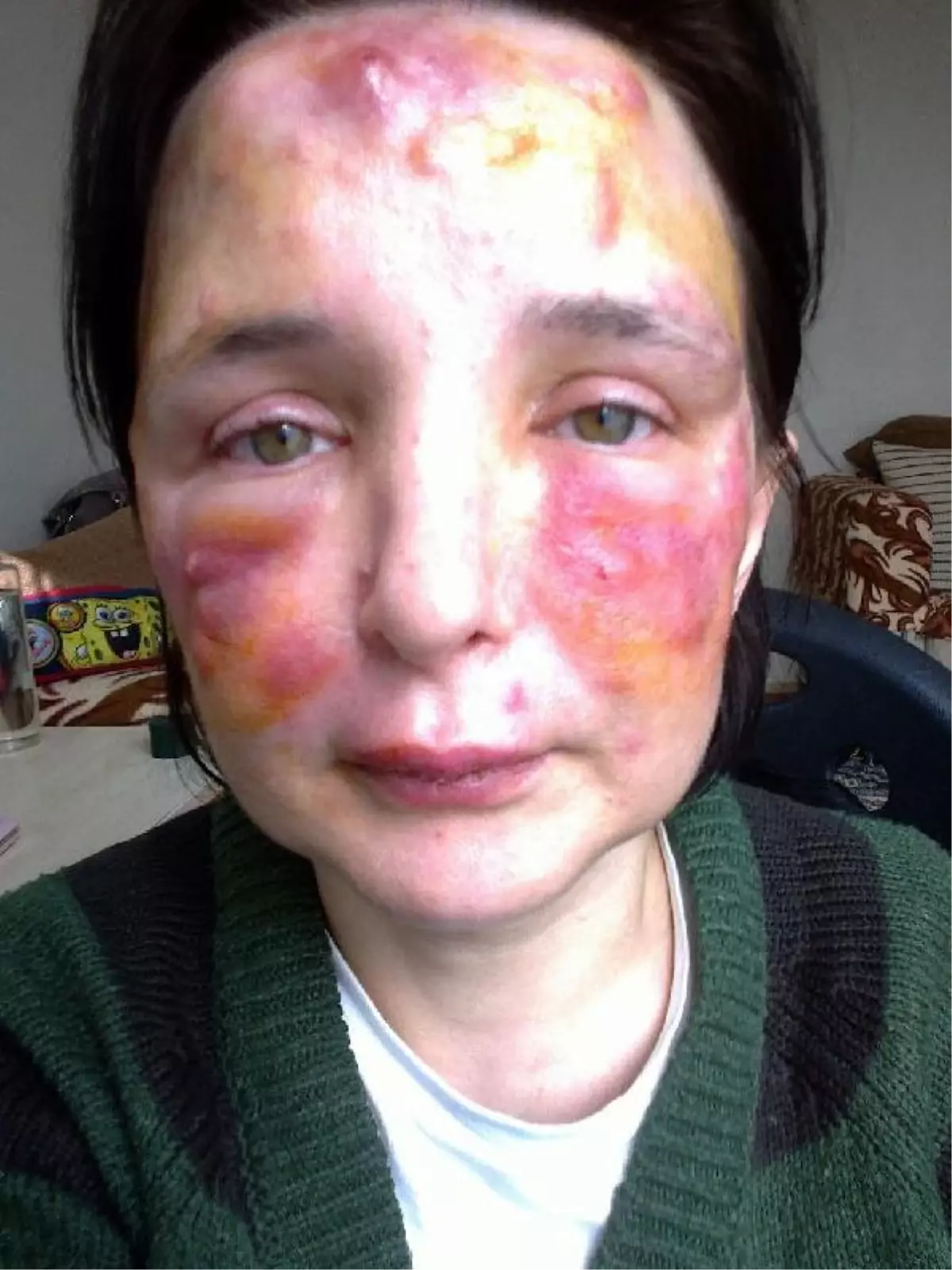 YÜZÜNE DOLGU YAPTIĞI KADININ HAYATINI KARARTAN SAHTE DOKTORA 3 YIL 4 AY HAPİS