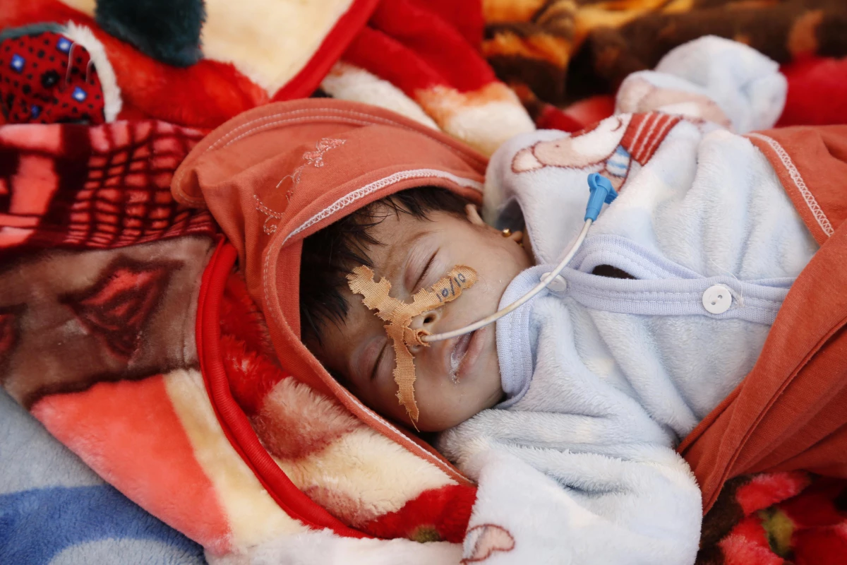 Yemen\'de kol gezen kıtlık çocukların hayatını tehdit ediyor