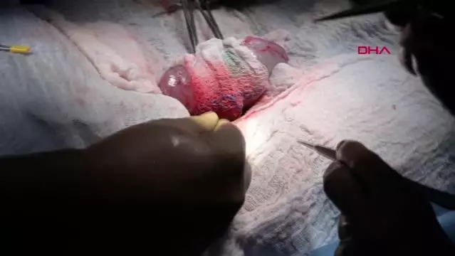 Alternatif organ kaynağı: Domuzdan böbrek nakli