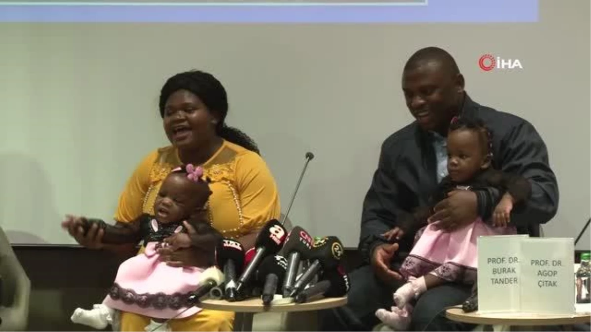 Kamerunlu yapışık ikizler Türkiye\'de yeniden doğdu