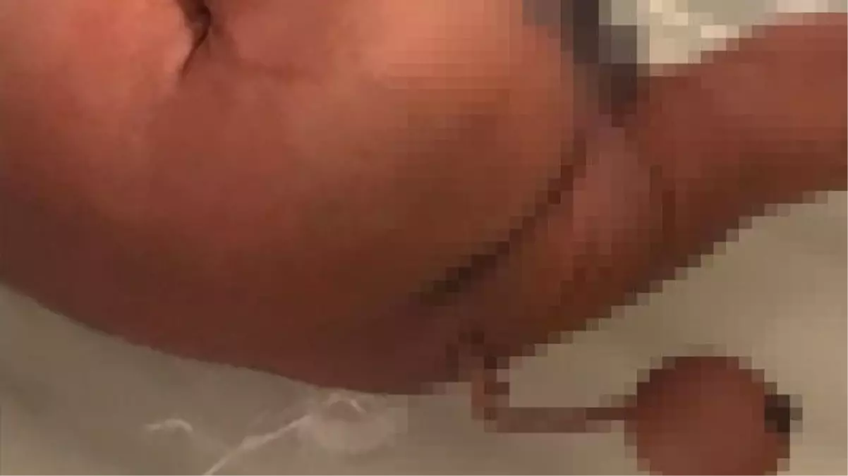 İnsanlık tarihine adını yazdıran doğum! Kuyruklu bebek, doktorları şaşkına çevirdi