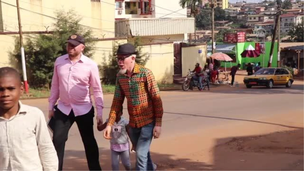 Kamerun\'da albinoslar büyü ve batıl inançlar yüzünden tehdit altında