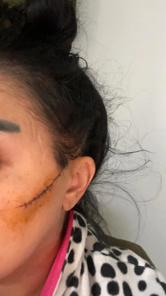 Adana'da eski erkek arkadaşının usturalı saldırısına uğradığı iddia edilen kadın yaralandı