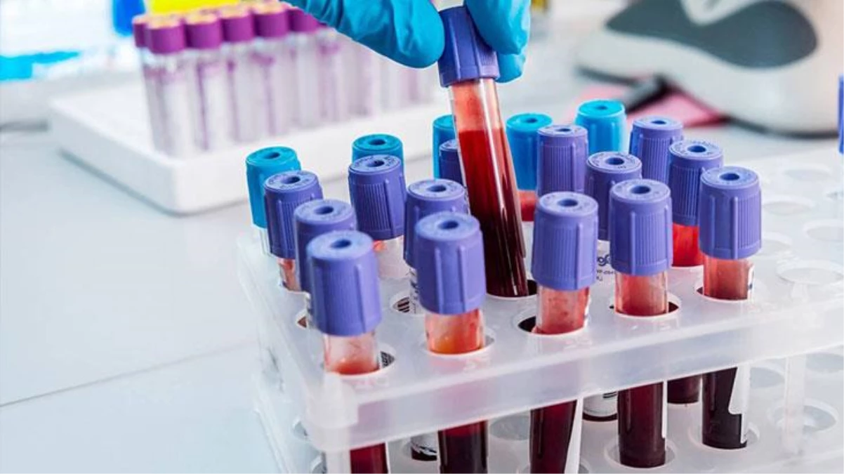 Bilim insanlarının araştırması ortaya çıkardı! Hastalıklara karşı en dirençli kan grubu belirlendi