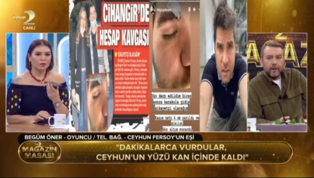 Eşi Ceyhun Fersoy'la saldırıya uğrayan Begüm Öner o anları anlattı: Yere düşürdükten sonra tekmeleyip yumrukladılar