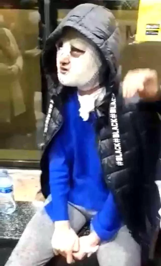 İskenderun'da eski sözlü dehşeti... Uyuşturucu madde verip cinsel şiddette bulundu, üzerine kızgın yağ dökerek tanınmaz hale getirdi