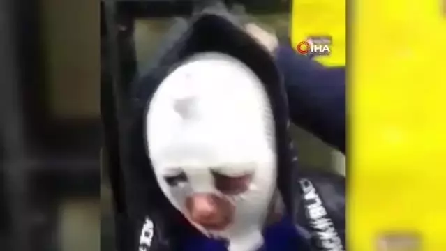 İskenderun'da eski sözlü dehşeti... Uyuşturucu madde verip cinsel şiddette bulundu, üzerine kızgın yağ dökerek tanınmaz hale getirdi İskenderun'da eski sözlü dehşeti... Uyuşturucu madde verip cinsel şiddette bulundu, üzerine kızgın yağ dökerek tanınmaz hale getirdi